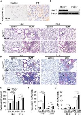 Protein Kinase C δ (PKCδ) Attenuates Bleomycin Induced Pulmonary Fibrosis via Inhibiting NF-κB Signaling Pathway